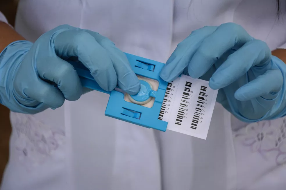 KIT dna